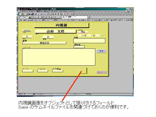 電子カルテの内視鏡フォーム