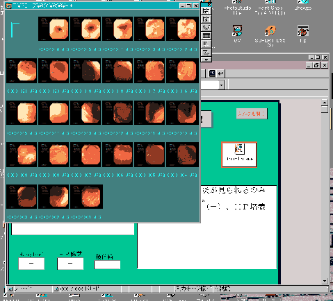 電子カルテ（まがい）内視鏡画面